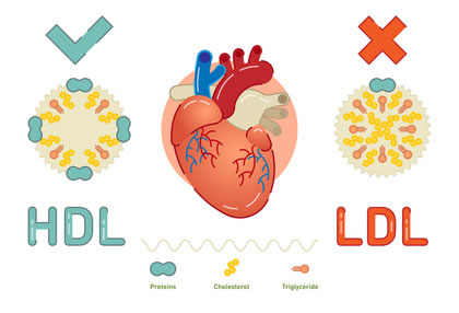 Herzinfarkt Unterschied HDL-LDL